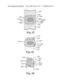 IN SITU ADJUSTABLE DYNAMIC INTERVERTEBRAL IMPLANT diagram and image