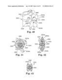 IN SITU ADJUSTABLE DYNAMIC INTERVERTEBRAL IMPLANT diagram and image