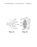 IN SITU ADJUSTABLE DYNAMIC INTERVERTEBRAL IMPLANT diagram and image