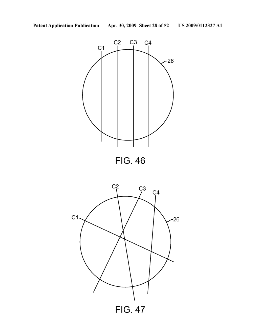 BURR HOLE PLUG DESIGNS - diagram, schematic, and image 29