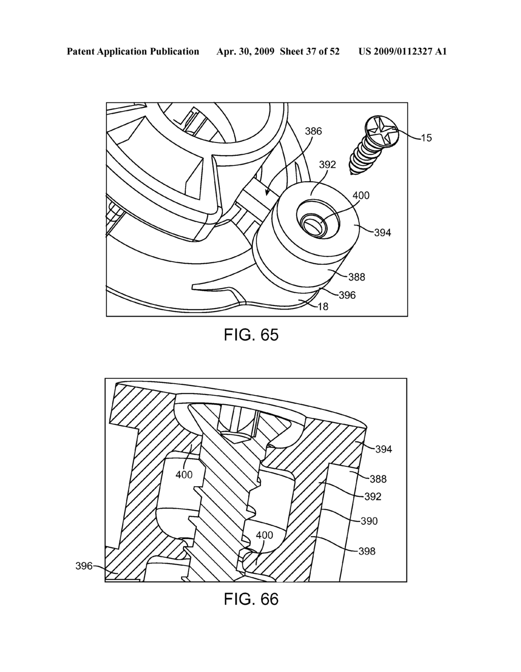 BURR HOLE PLUG DESIGNS - diagram, schematic, and image 38