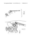 METHOD OF SURFACE OXIDIZING ZIRCONIUM AND ZIRCONIUM ALLOYS AND RESULTING PRODUCT diagram and image