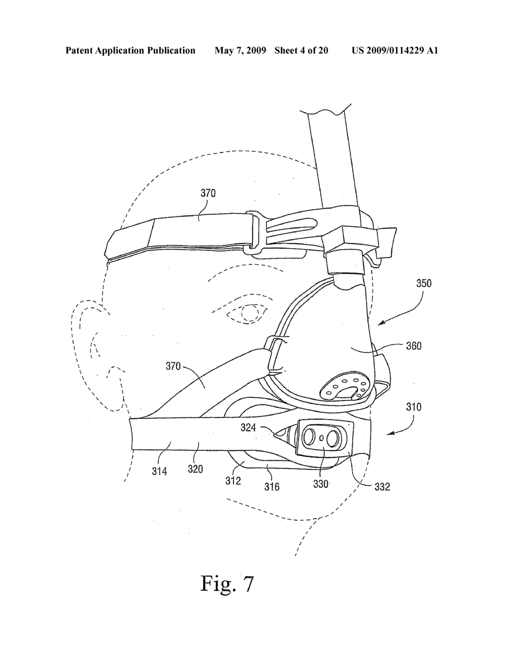 Mouth Seal Assembly for Nasal Mask System - diagram, schematic, and image 05