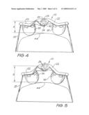 FOREHEAD SUPPORT FOR A FACIAL MASK diagram and image