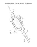 Stapling Device diagram and image