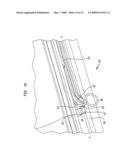 Stapling Device diagram and image