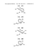 Stapling Device diagram and image