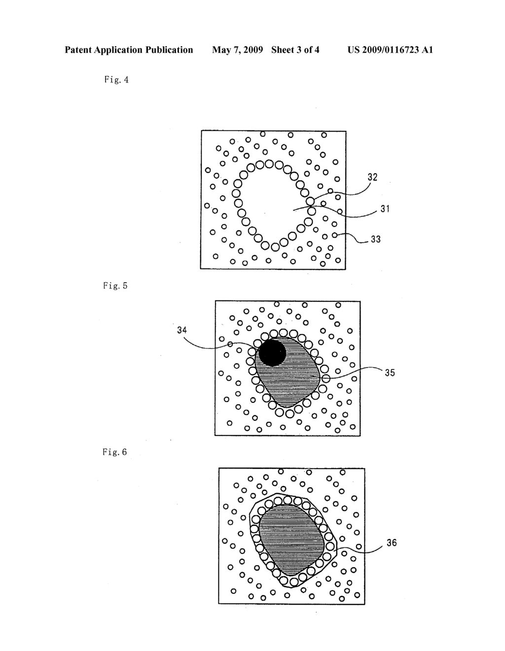 MODULE FOR DETECTING POORLY DIFFERENTIATED CANCERS AND PATHOLOGICAL IMAGE DIAGNOSIS SUPPORT APPARATUS, PROGRAM AND RECORDING MEDIUM INCLUDING THE SAME - diagram, schematic, and image 04