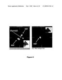 Radiologic Agents for Monitoring Alzheimer s Disease Progression and Evaluating a Response to Therapy and Processes for the Preparation of Such Agents diagram and image