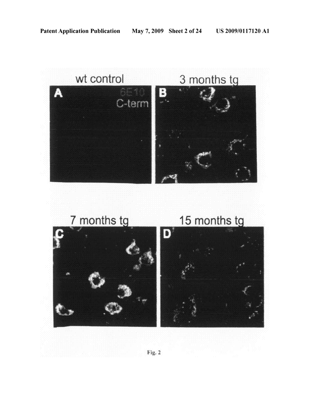 Transgenic animal model for alzheimer's disease - diagram, schematic, and image 03