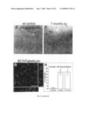 Transgenic animal model for alzheimer s disease diagram and image