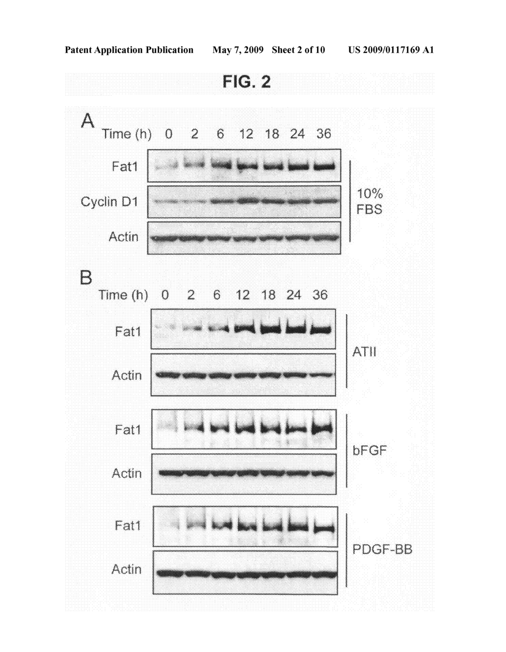 Methods and compositions for regulating proliferation and migration of vascular smooth muscle cells - diagram, schematic, and image 03