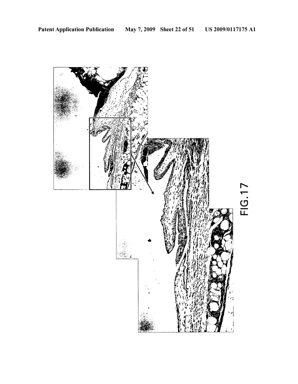 HEMOSTATIC COMPOSITIONS AND THERAPEUTIC REGIMENS - diagram, schematic, and image 23