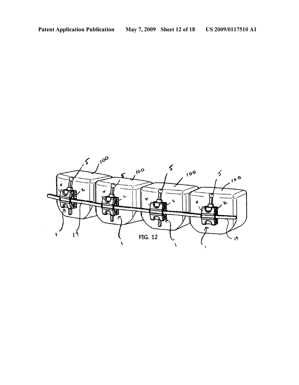 Orthodontic Apparatus With Self-Ligating Bracket and Locking Device - diagram, schematic, and image 13