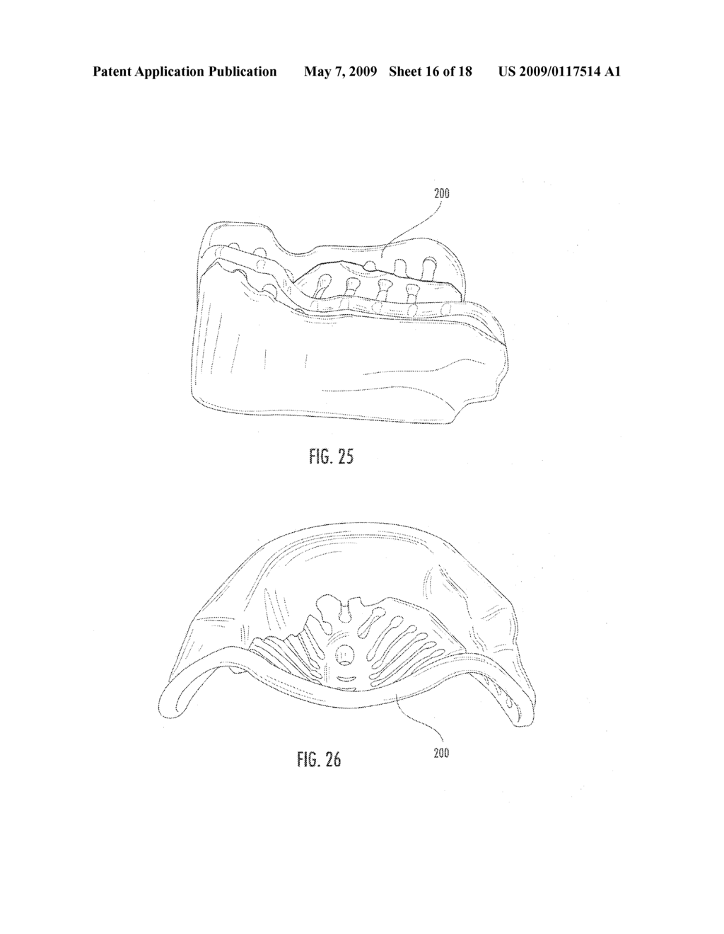 METHOD AND COMPONENTS FOR PRODUCING EDENTULOUS DENTURES - diagram, schematic, and image 17