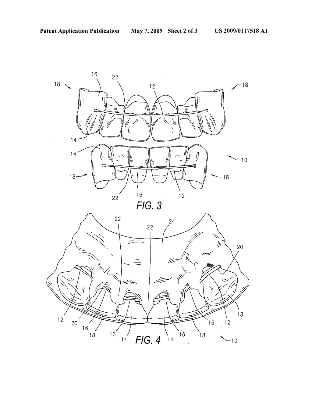 DENTURE TEETH DEVICE AND METHOD - diagram, schematic, and image 03