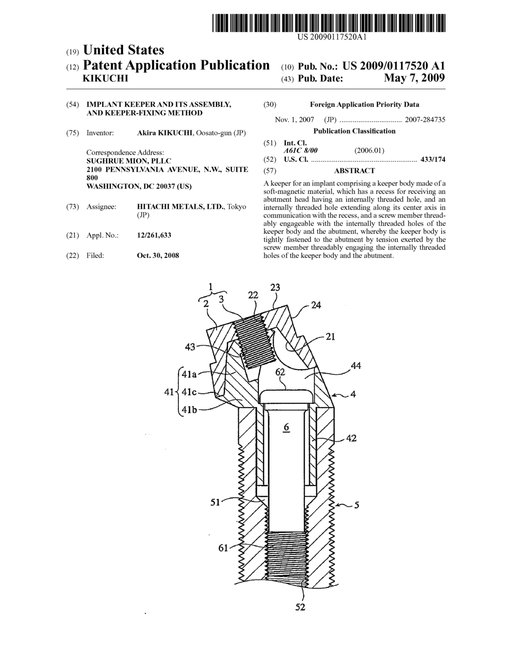 IMPLANT KEEPER AND ITS ASSEMBLY, AND KEEPER-FIXING METHOD - diagram, schematic, and image 01