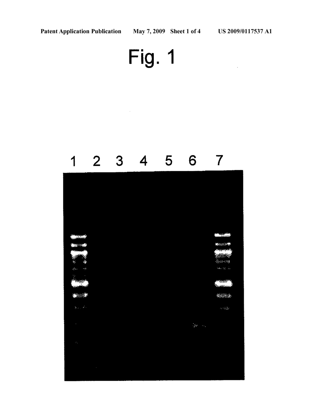 METHOD FOR DETECTING SARS CORONAVIRUS - diagram, schematic, and image 02