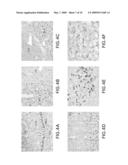 ISOLATED SOLUBLE CORTICOTROPIN RELEASING FACTOR RECEPTOR TYPE 2 (SCRFR2) diagram and image