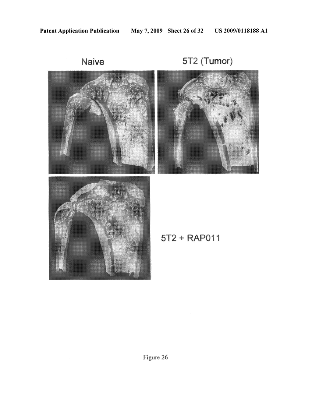 Activin-actriia antagonists and uses for decreasing or inhibiting FSH secretion - diagram, schematic, and image 27