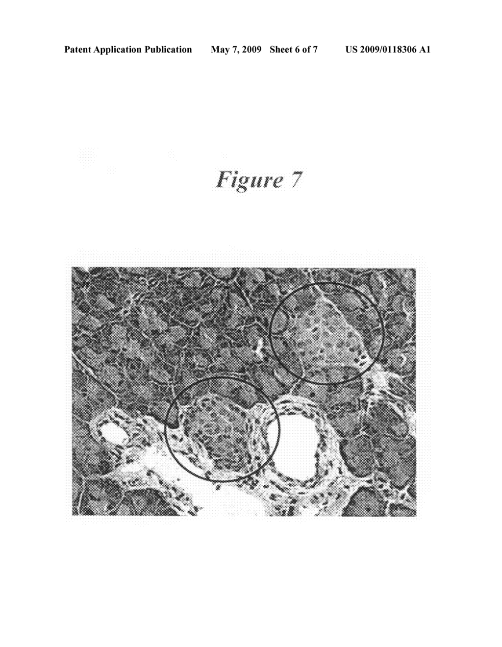 Novel use of liver X receptor agonists - diagram, schematic, and image 07