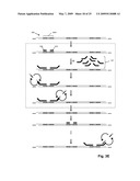 High throughput genome sequencing on DNA arrays diagram and image