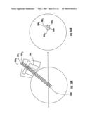 MRI-GUIDED LOCALIZATION AND/OR LEAD PLACEMENT SYSTEMS, RELATED METHODS, DEVICES AND COMPUTER PROGRAM PRODUCTS diagram and image