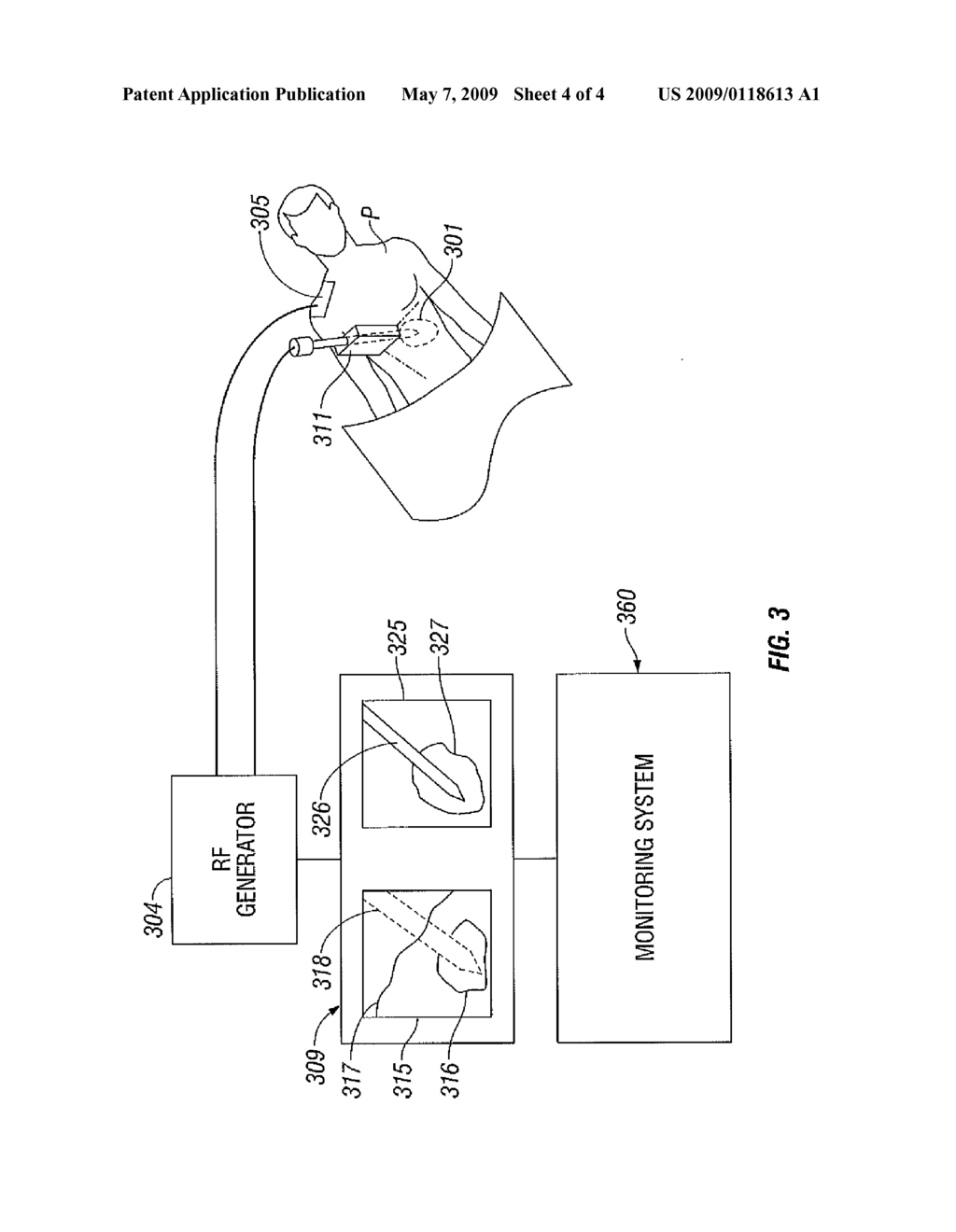 Method for Volume Determination and Geometric Reconstruction - diagram, schematic, and image 05