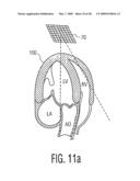 Three Dimensional Ultrasonic Scanning With a Steerable Volumetric Region diagram and image