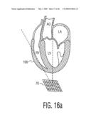 Three Dimensional Ultrasonic Scanning With a Steerable Volumetric Region diagram and image