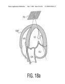 Three Dimensional Ultrasonic Scanning With a Steerable Volumetric Region diagram and image