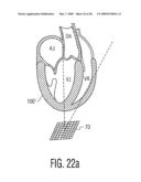 Three Dimensional Ultrasonic Scanning With a Steerable Volumetric Region diagram and image