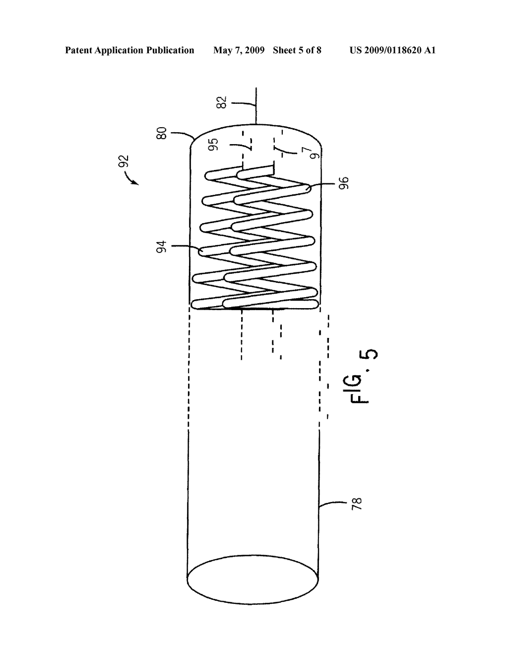 SYSTEM AND METHOD FOR TRACKING AN ULTRASOUND CATHETER - diagram, schematic, and image 06