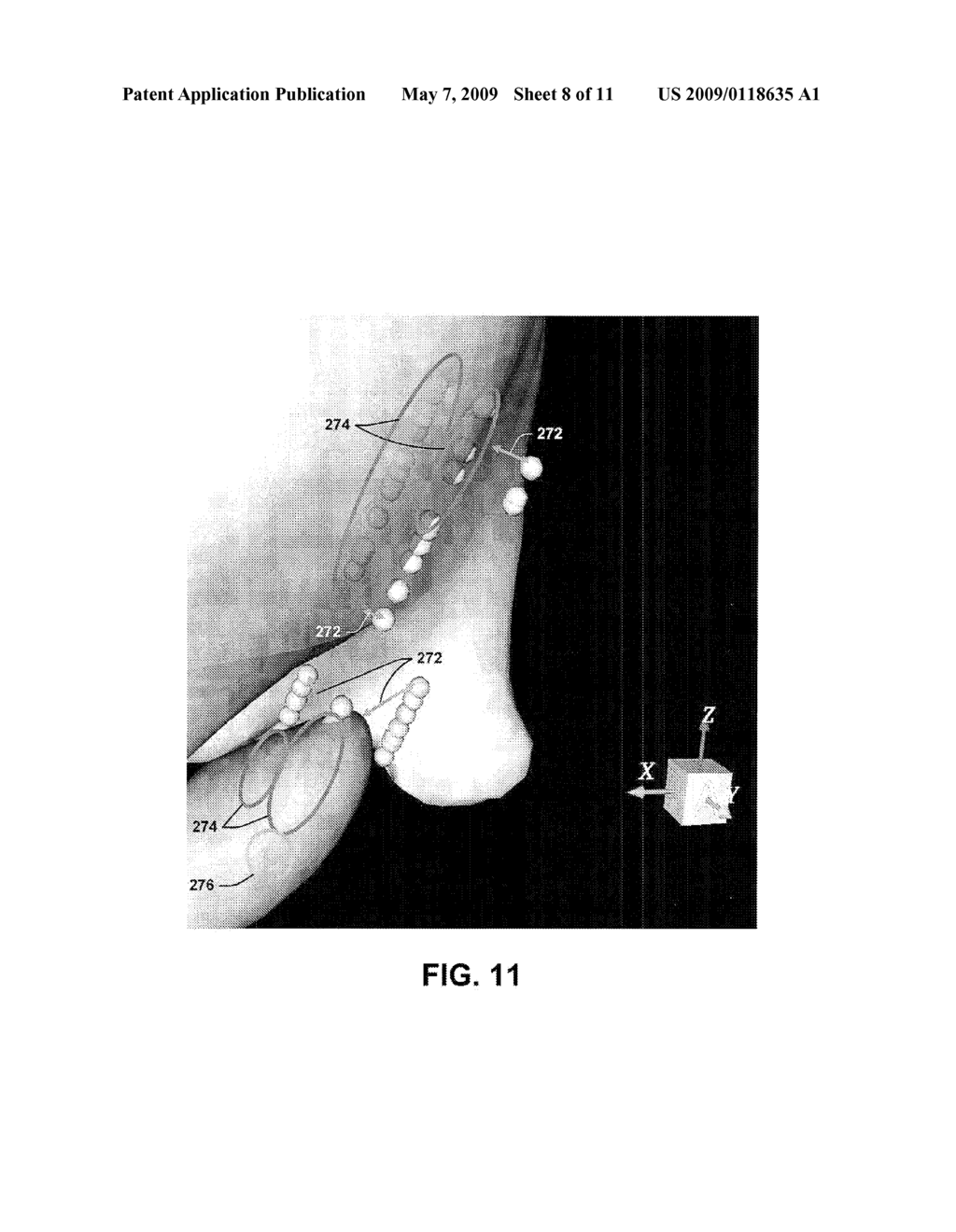 AUTOMATED 3D BRAIN ATLAS FITTING USING INTRA-OPERATIVE NEUROPHYSIOLOGICAL DATA - diagram, schematic, and image 09