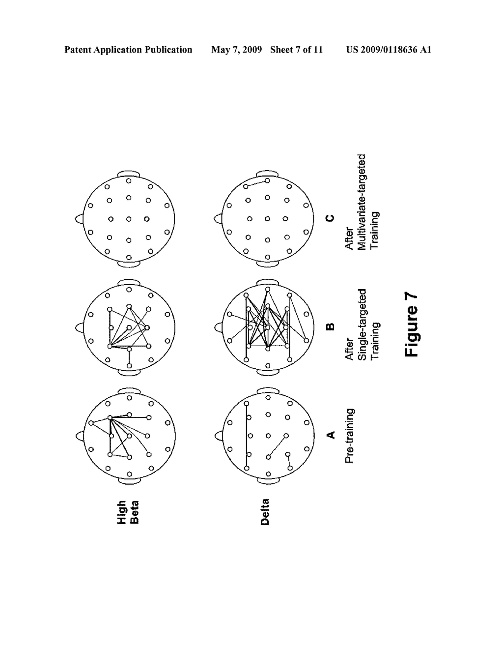 Multi-Channel, Multi-Variate Whole-Head Normalization Using Live Z-Scores - diagram, schematic, and image 08