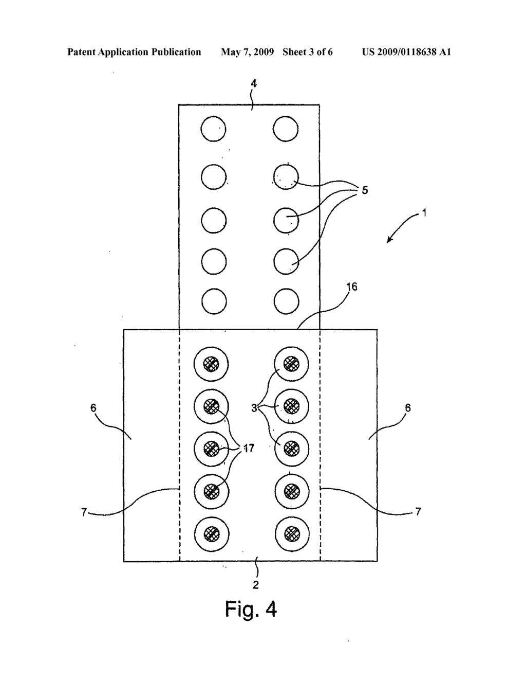 Device for Performing an Allergy Test - diagram, schematic, and image 04