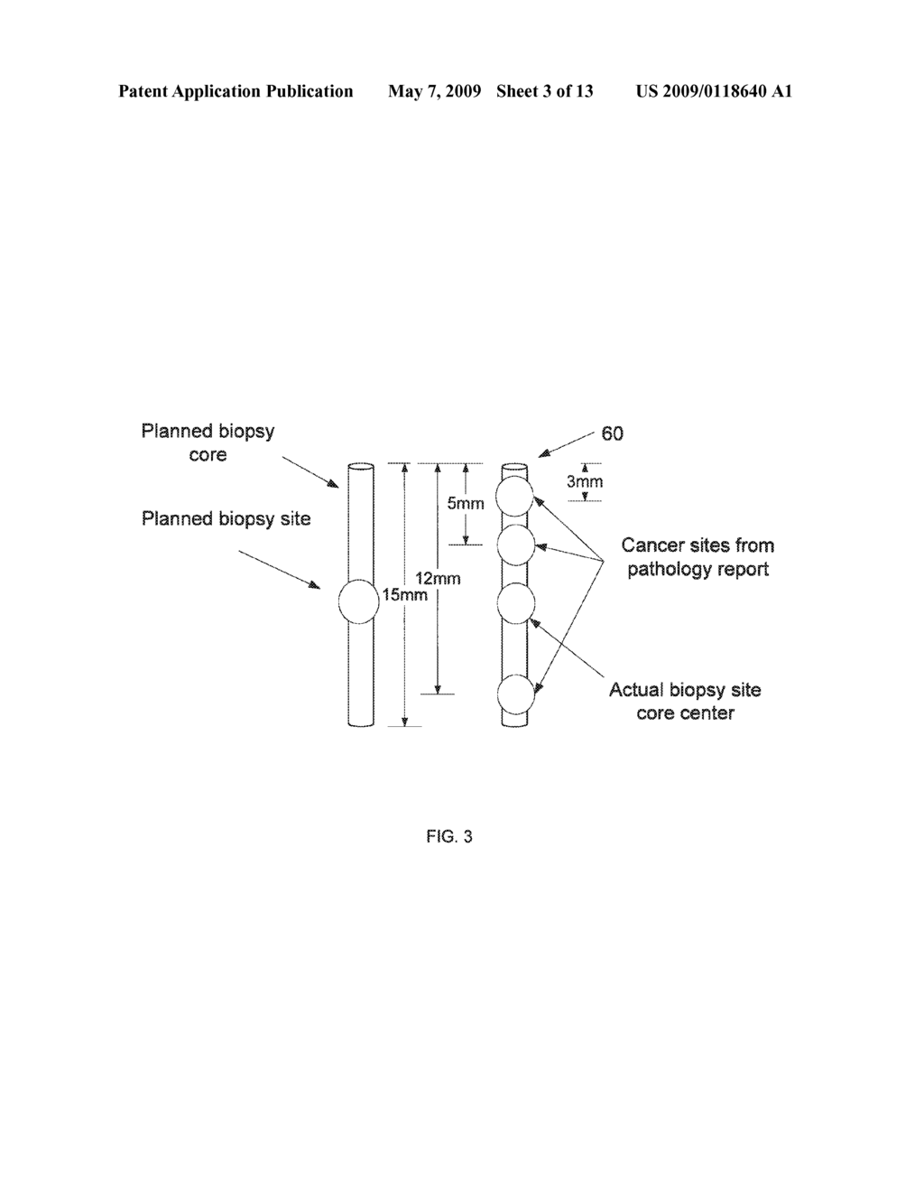 BIOPSY PLANNING AND DISPLAY APPARATUS - diagram, schematic, and image 04