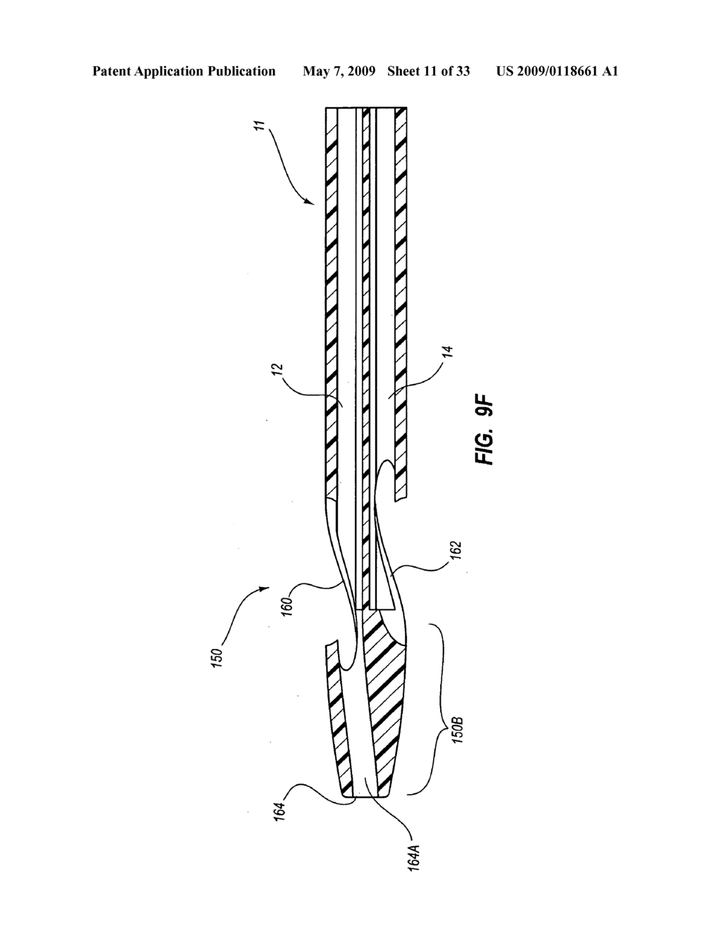 CATHETER ASSEMBLY INCLUDING TRIPLE LUMEN TIP - diagram, schematic, and image 12