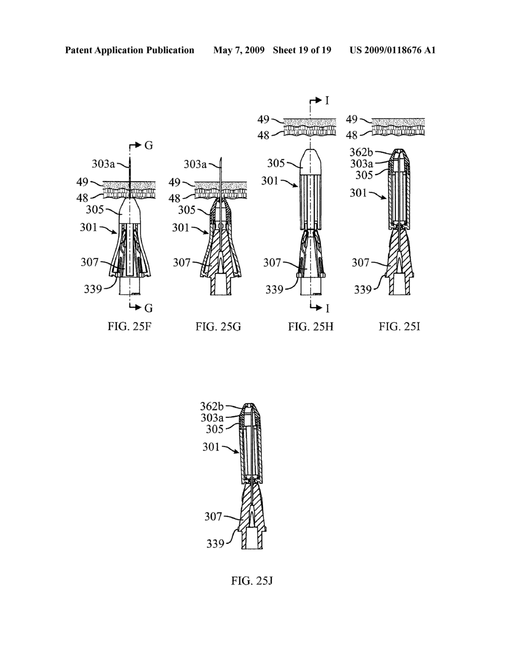 SAFETY NEEDLE - diagram, schematic, and image 20