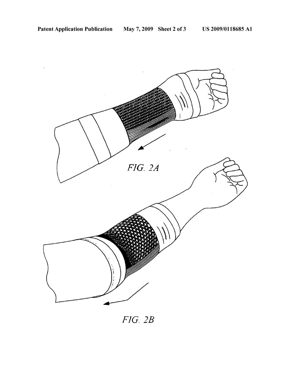 Medicated sleeve - diagram, schematic, and image 03