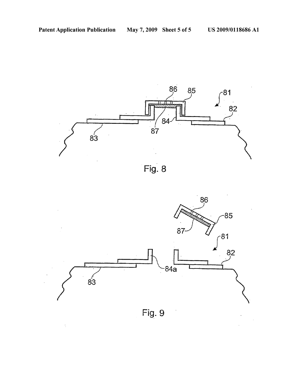 COLOSTOMY ARRANGEMENTS - diagram, schematic, and image 06