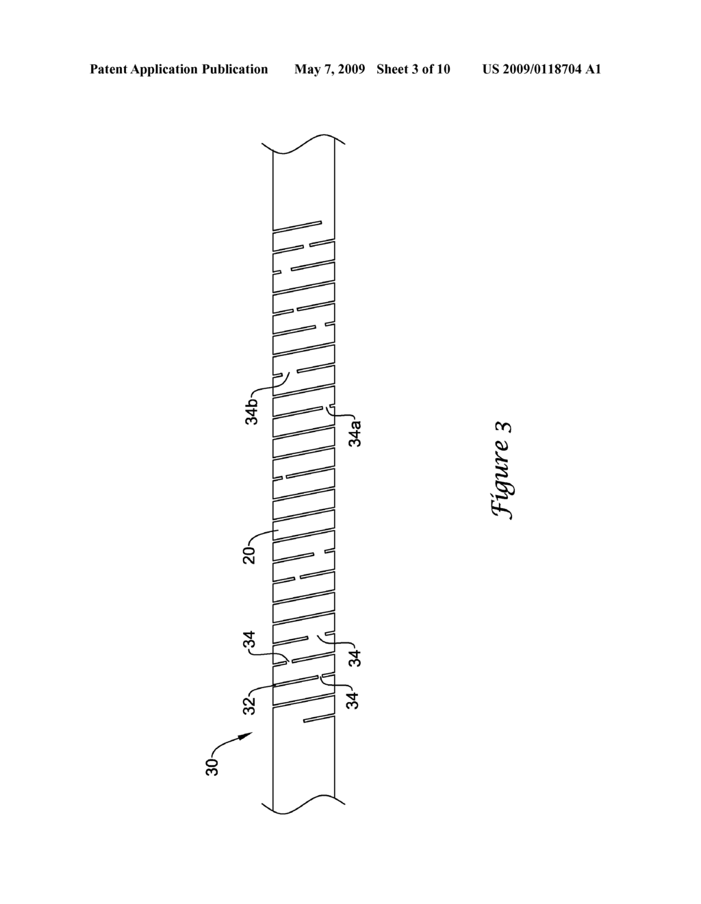 INTERCONNECTED RIBBON COILS, MEDICAL DEVICES INCLUDING AN INTERCONNECTED RIBBON COIL, AND METHODS FOR MANUFACTURING AN INTERCONNECTED RIBBON COIL - diagram, schematic, and image 04