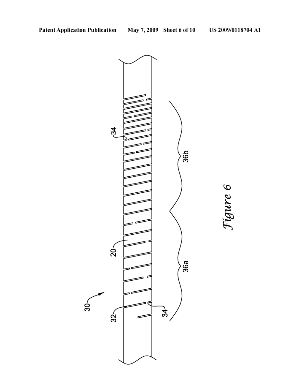 INTERCONNECTED RIBBON COILS, MEDICAL DEVICES INCLUDING AN INTERCONNECTED RIBBON COIL, AND METHODS FOR MANUFACTURING AN INTERCONNECTED RIBBON COIL - diagram, schematic, and image 07