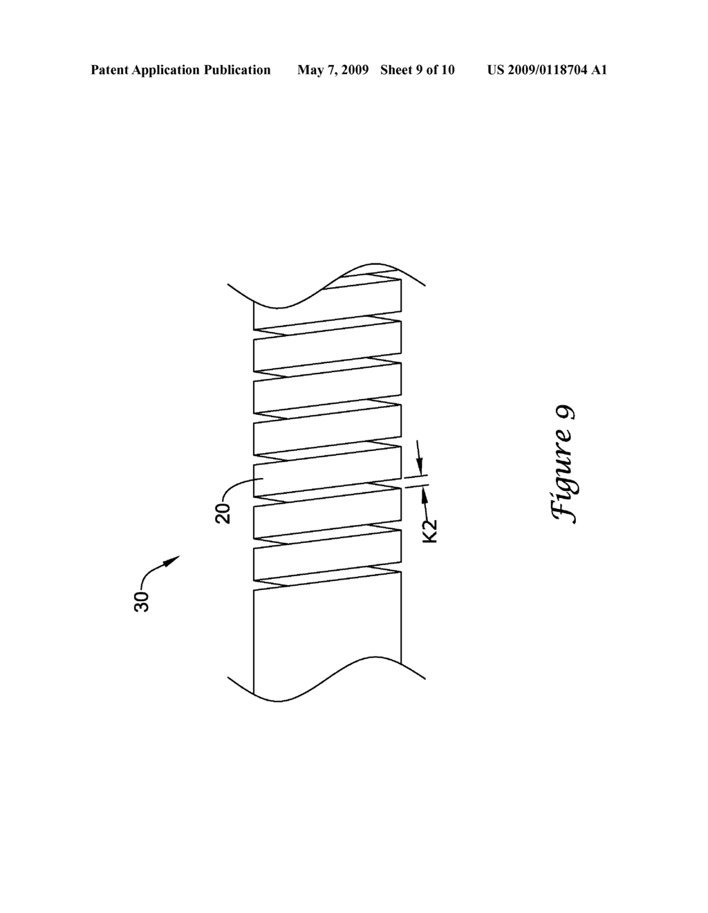 INTERCONNECTED RIBBON COILS, MEDICAL DEVICES INCLUDING AN INTERCONNECTED RIBBON COIL, AND METHODS FOR MANUFACTURING AN INTERCONNECTED RIBBON COIL - diagram, schematic, and image 10
