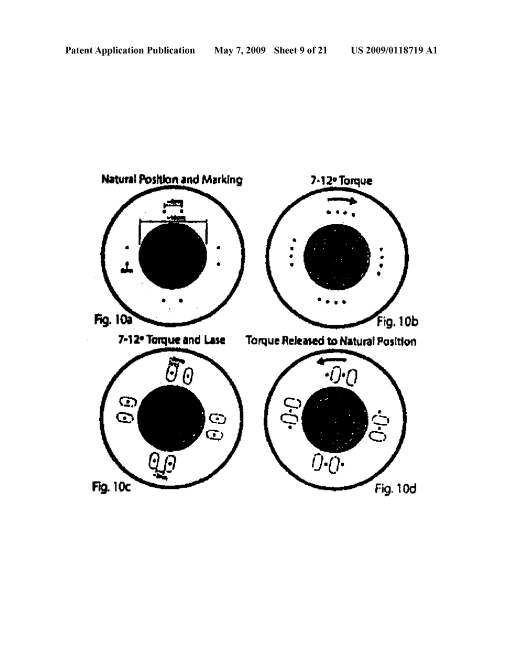 METHODS FOR TREATING EYE CONDITIONS - diagram, schematic, and image 10