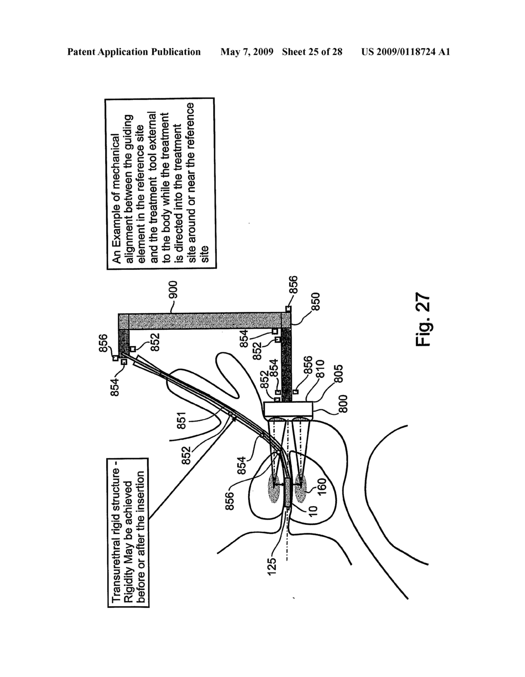 Method and Apparatus for Positioning a Medical Instrument - diagram, schematic, and image 26