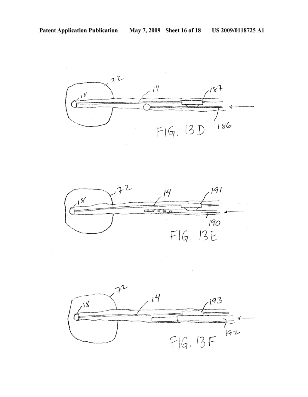 HEMOSTATIC TISSUE TUNNEL GENERATOR FOR INSERTING TREATMENT APPARATUS INTO TISSUE OF A PATIENT - diagram, schematic, and image 17