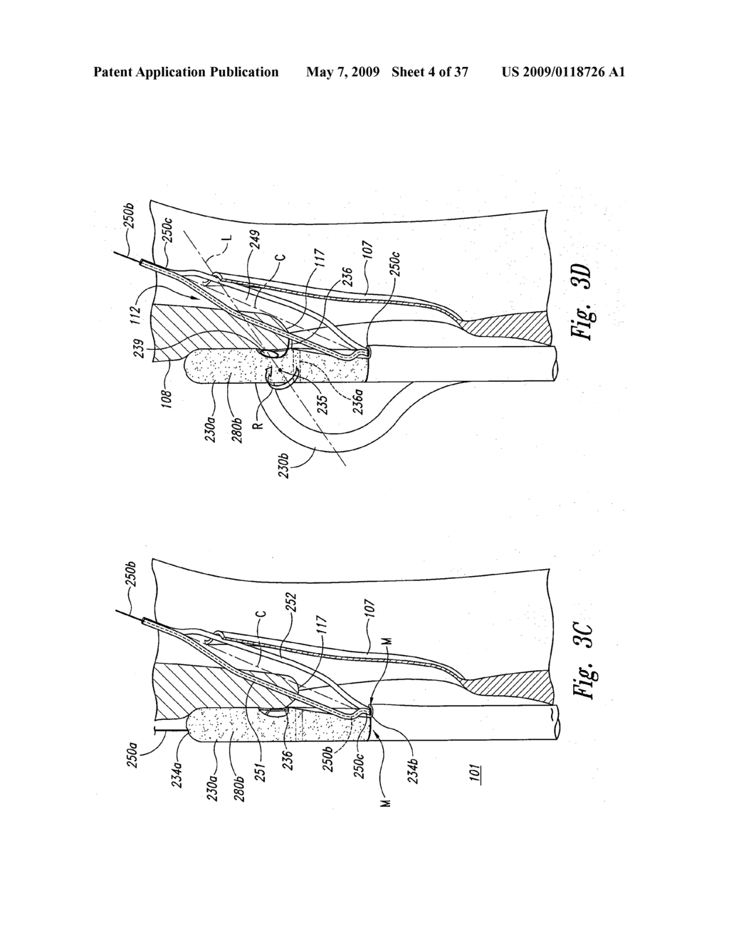 Systems and Methods for Transeptal Cardiac Procedures, Including Tissue Sealing Members Associated Methods - diagram, schematic, and image 05