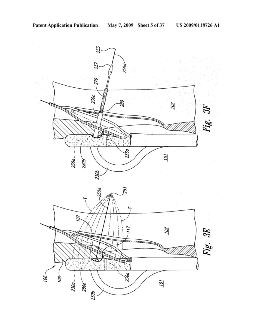 Systems and Methods for Transeptal Cardiac Procedures, Including Tissue Sealing Members Associated Methods - diagram, schematic, and image 06