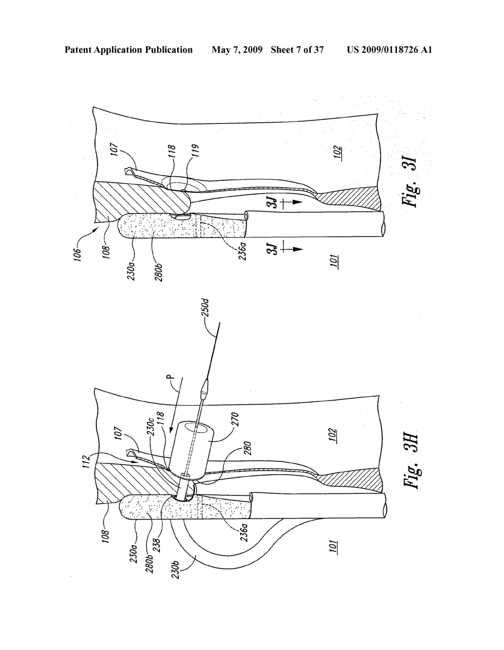 Systems and Methods for Transeptal Cardiac Procedures, Including Tissue Sealing Members Associated Methods - diagram, schematic, and image 08